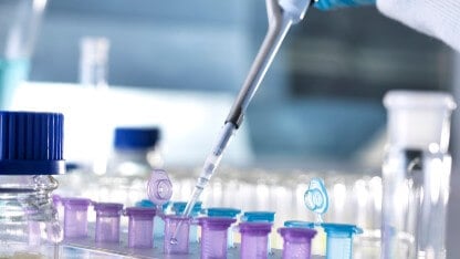 An analytical scientist's hand holds a pipette to prepare a sample for elemental analysis services, pipetting liquid into purple and blue sample vials.